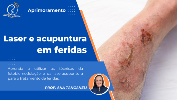 Laser e acupuntura em feridas