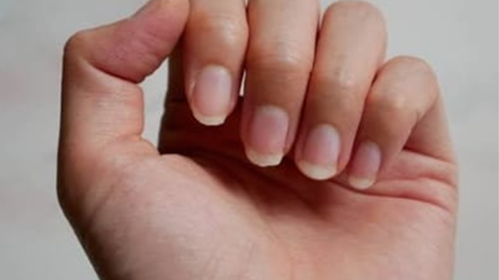 Inspeção das unhas na Medicina Chinesa