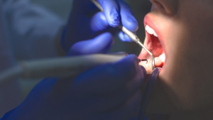 Acupuntura melhora dor e cessa sangramento na cirurgia dental
