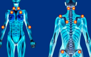 Estudo sobre fibromialgia aponta para a efetividade da acuúntura