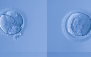 Acupuntura ajuda na implantação de embriões congelados