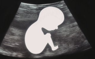 B67 para rotacionar bebês com apresentação pélvica