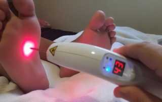 Os 9 mitos da laseracupuntura