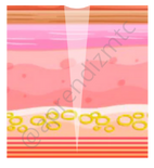 o ponto de acupuntura é uma via direta para o canal principal