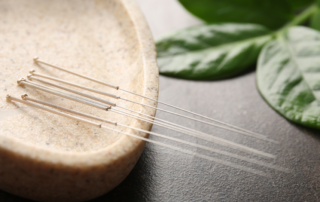 Combinação clássica: ponto yuan + ponto luo